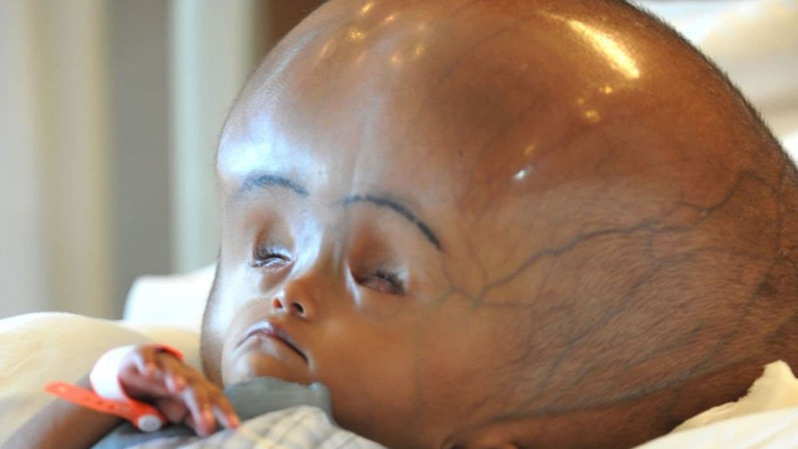 Life-Saving Surgeries